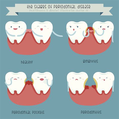 The Different Types of Gum Disease | smilesbygeorge