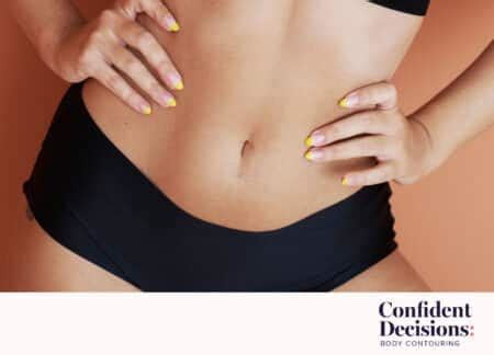 Your Guide to CoolSculpting Side Effects and Risks | RealSelf News