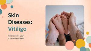 Skin Diseases: Vitiligo PowerPoint Templates Free Download