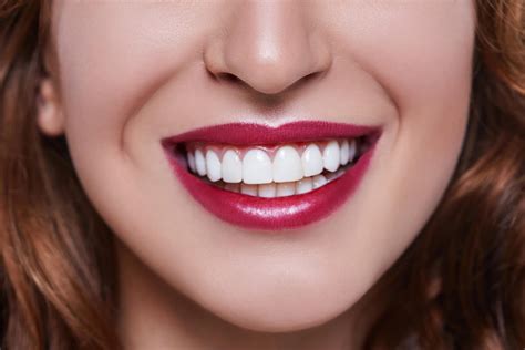 Are Veneers Permanent? – Roosevelt Dental Center