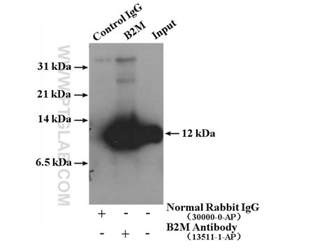 Beta-2-microglobulin Antibody (13511-1-AP)