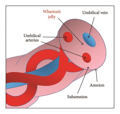 Cross Section In Umbilical Cord Shows The Folded Arterial Lumen And ...