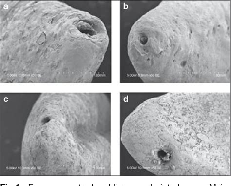 Figure 1 from Morphological analysis of apical foramen over ...