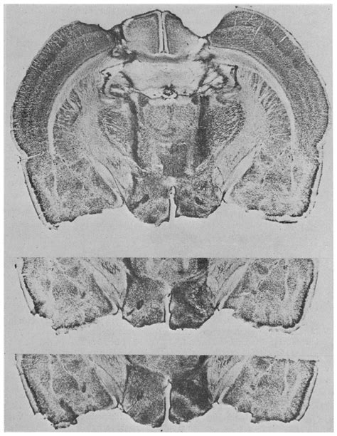 Bilateral transection of the medial forebrain bundle (M FB) with a ...