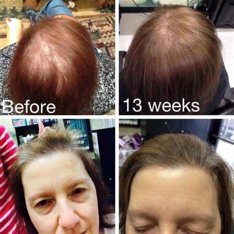 MONAT Global Revolutionary Hair Care Products: Amazing MONAT Before and ...