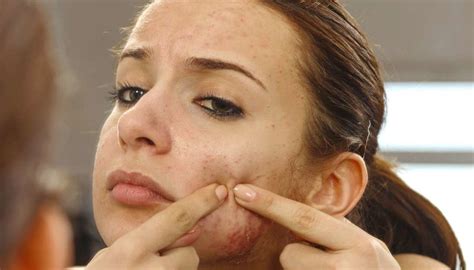 Infected pimple: Symptoms, diagnosis, and treatment