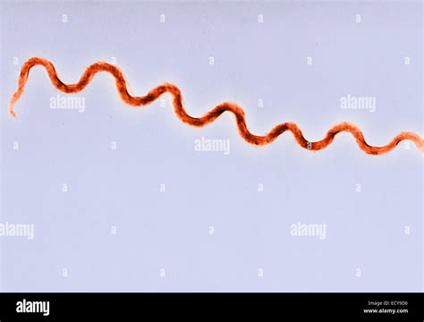 Treponema Pallidum Bacteria (Syphilis) Colorized Electron, 47% OFF