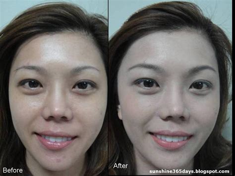 simpale: More Dermaline skin whitening bb cream before and after