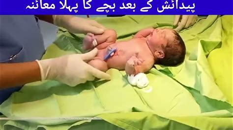 Newborn baby examination - YouTube