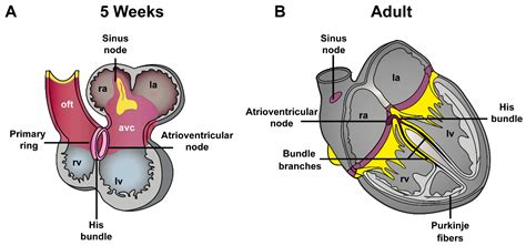 Bundle Of Kent Anatomy