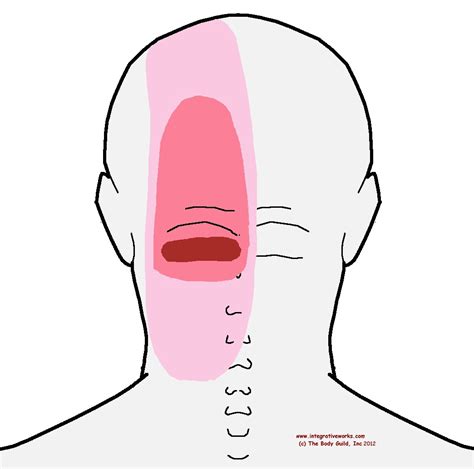 Headache from the base of your head | Integrative Works