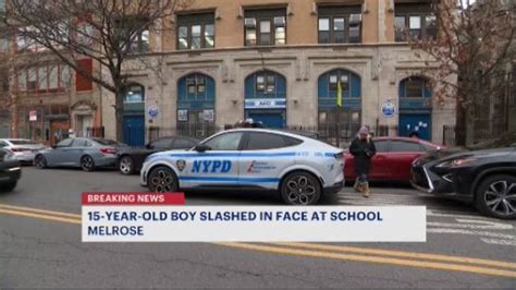 Police: 15-year-old student slashed in face at AECI Charter High School; another 15-year-old ...