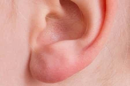 Bumps in Ear: Causes, Signs and Treatment - Health Advisor