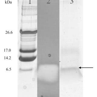 Tricine–SDS-PAGE of purified BacSJ. Lane 1 = Ultra low– range... | Download Scientific Diagram