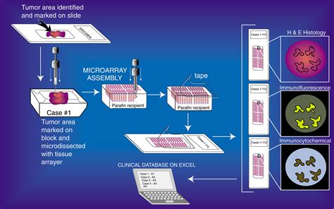 How to Construct Tissue Microarrays