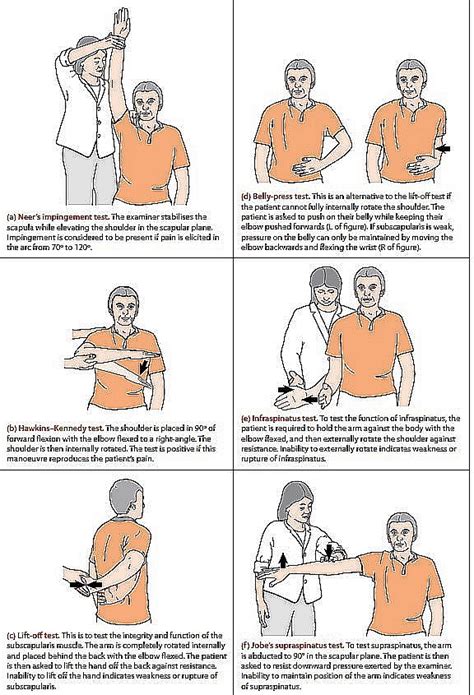 Jobe's supraspinatus test - General Practice Notebook | Geriatric ...