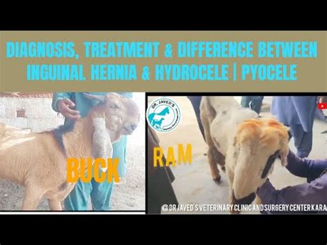 DIFFERENCE BETWEEN INGUINAL HERNIA & HYDROCELE & PYOCELE IN BUCK & RAM ...