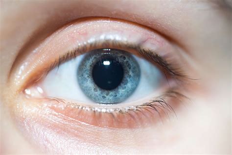 Dilated Pupils: Symptoms, Causes, and Treatment