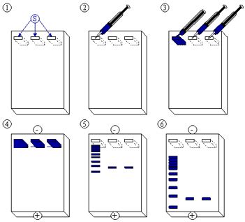 Agarose gel electrophoresis of DNA | Cleaver Scientific