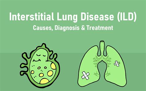 Interstitial Lung Disease – Causes, Diagnosis & Treatment