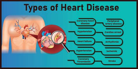 Heart Disease Causes, Prevention and Treatment