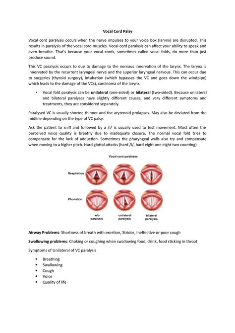 Vocal Cord Palsy - Vocal Cord Palsy Vocal cord paralysis occurs when the nerve impulses to your ...