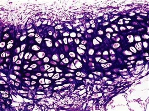 Elastic cartilage is similar to hyaline cartilage as it has chondroblasts within a lacuna ...