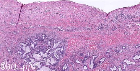 Lung Histology Visceral Pleura Histology Slide Photos | Hot Sex Picture