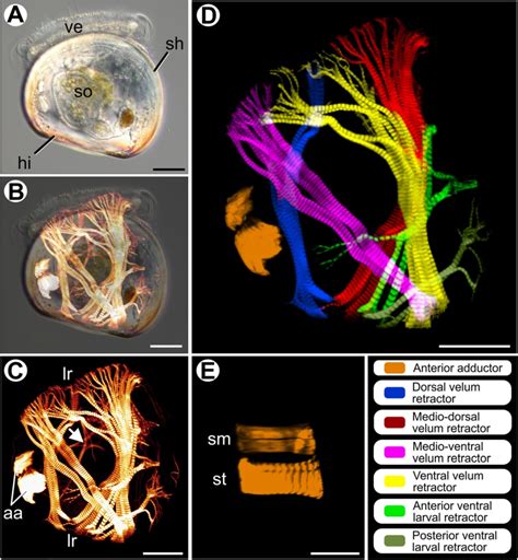 Myoanatomy of Nodipecten nodosus veliger larvae. Anterior to the top in ...