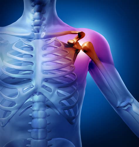 Separated Shoulder | India| PDF | PPT| Case Reports | Symptoms | Treatment