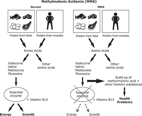 Methylmalonic acidemia causes, symptoms, diagnosis, treatment & prognosis