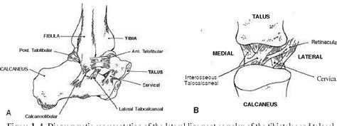 Figure 1 from Instability of the subtalar joint. | Semantic Scholar