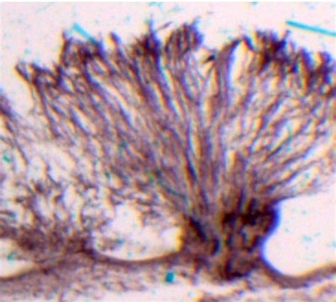 Mold (Bread) Prepared Microscope Slide