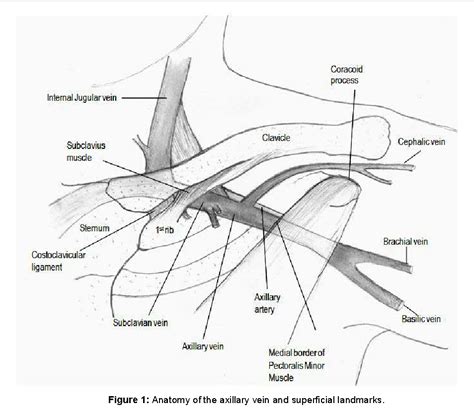 Axillary Vein Cephalic Vein