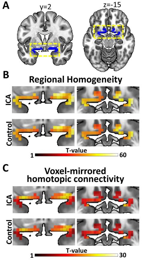 Connectivity results for the olfactory cortex. (A) Primary olfactory ...