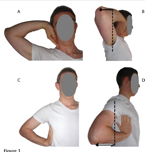 Upper Limb Tension Test Ulnar Nerve – NBKomputer