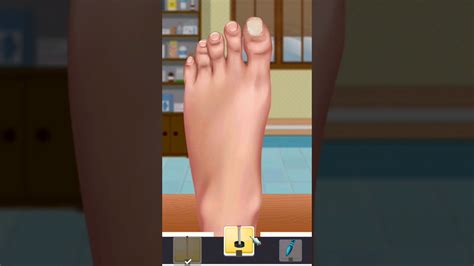 New Foot Surgery - YouTube