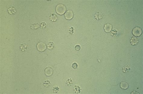 Urinalysis