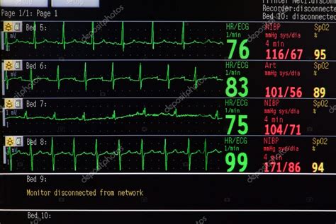 ICU monitor — Stock Photo © beerkoff1 #6335166