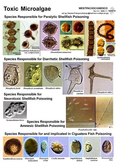 Plankton Identification