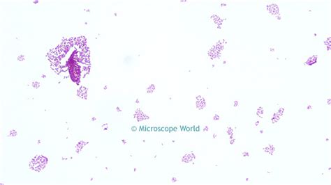 Microscope World Blog: Salmonella under the Microscope