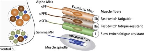 Lower motor neuron lesion, causes, signs & symptoms