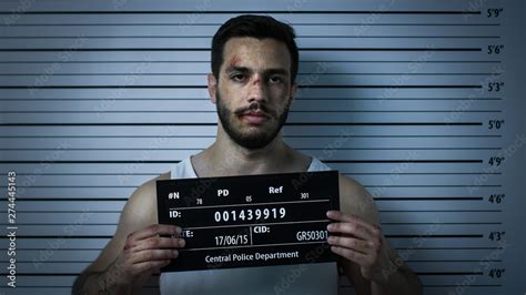 Close-up Shot of an Arrested Beaten Man in a Police Station Poses for ...