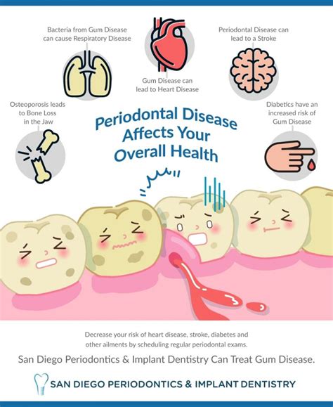 How Periodontal Disease Affects Your Overall Health