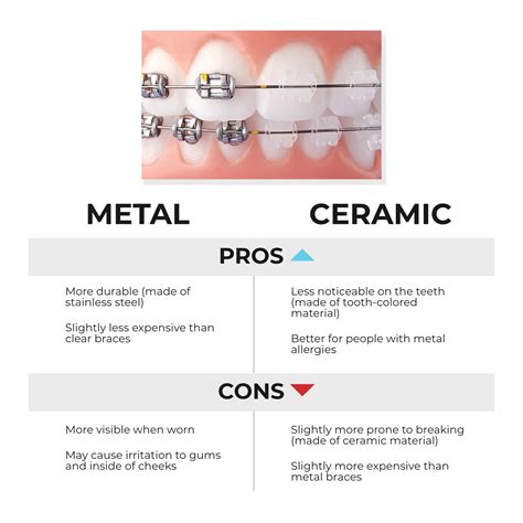 Ceramic Braces vs. Metal Braces: Pros, Cons, and Cost