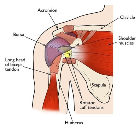 Shoulder Impingement – Modern Orthopaedics of New Jersey