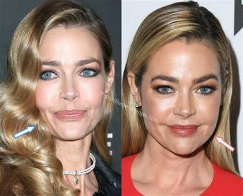 Denise Richards: BEFORE and AFTER 2019