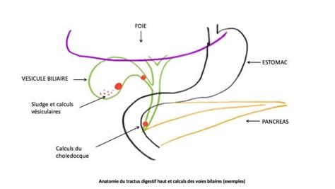 Vésicule biliaire – Dr Abdellatif Al Aarabiou