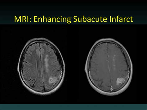 Introductory/ Neuroimaging: What you need to know at 3 am And some cool ...