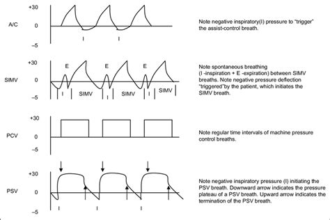 Mechanical Ventilation Manual Basic Modes Of Mechanical, 52% OFF